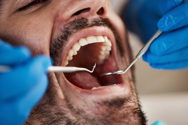 Oral Surgery in Bellflower, CA